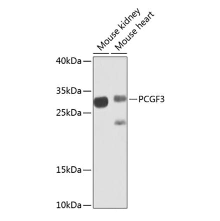 Western Blot - Anti-PCGF3 Antibody (A15714) - Antibodies.com