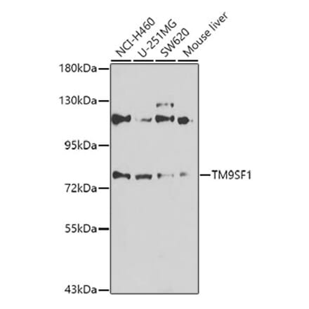 Western Blot - Anti-TM9SF1 Antibody (A15715) - Antibodies.com