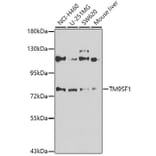 Western Blot - Anti-TM9SF1 Antibody (A15715) - Antibodies.com