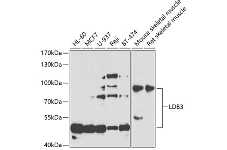 Western Blot - Anti-LDB3 Antibody (A15716) - Antibodies.com
