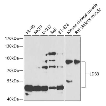 Western Blot - Anti-LDB3 Antibody (A15716) - Antibodies.com