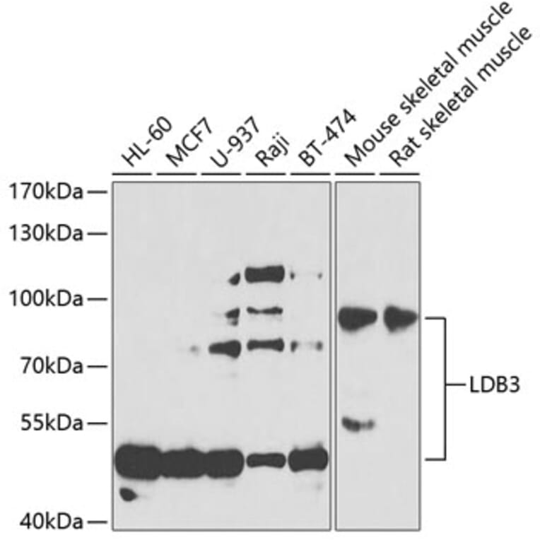 Western Blot - Anti-LDB3 Antibody (A15716) - Antibodies.com