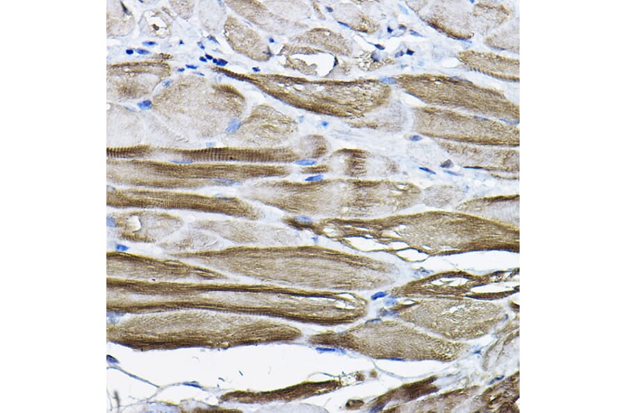 Immunohistochemistry - Anti-LDB3 Antibody (A15716) - Antibodies.com