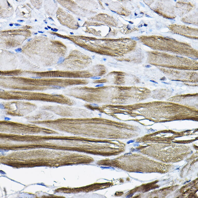 Immunohistochemistry - Anti-LDB3 Antibody (A15716) - Antibodies.com