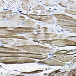 Immunohistochemistry - Anti-LDB3 Antibody (A15716) - Antibodies.com