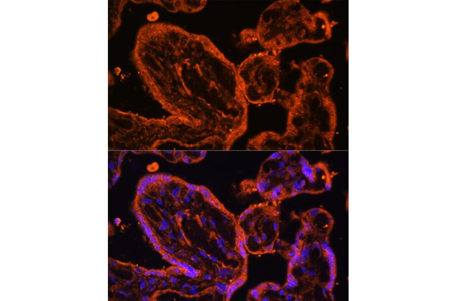 Immunofluorescence - Anti-LDB3 Antibody (A15716) - Antibodies.com