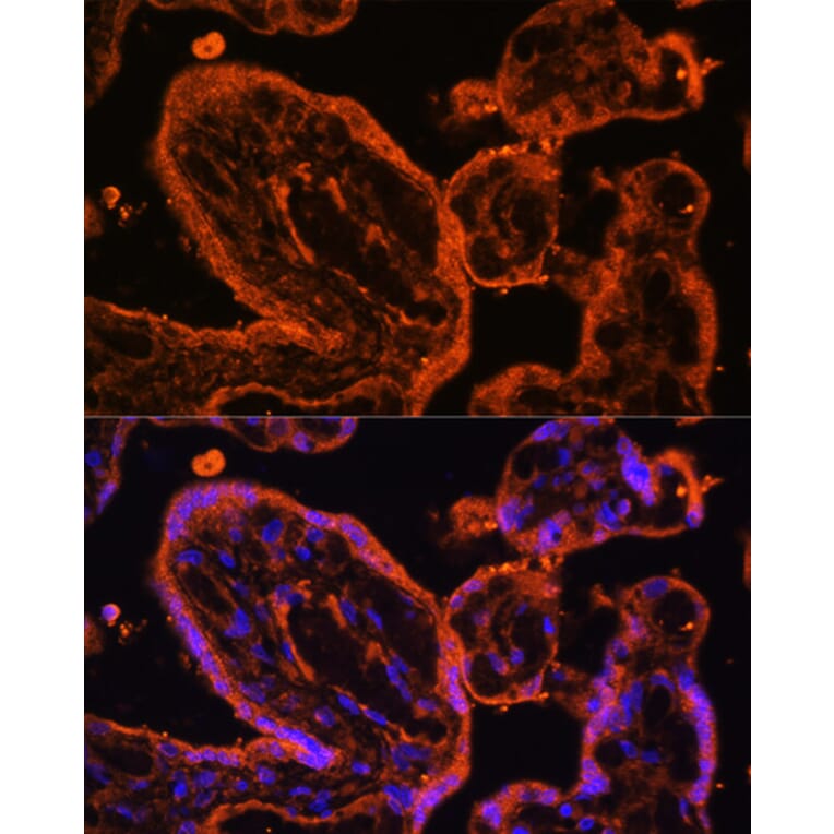 Immunofluorescence - Anti-LDB3 Antibody (A15716) - Antibodies.com