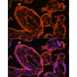 Immunofluorescence - Anti-LDB3 Antibody (A15716) - Antibodies.com