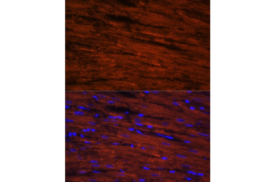 Immunofluorescence - Anti-LDB3 Antibody (A15716) - Antibodies.com