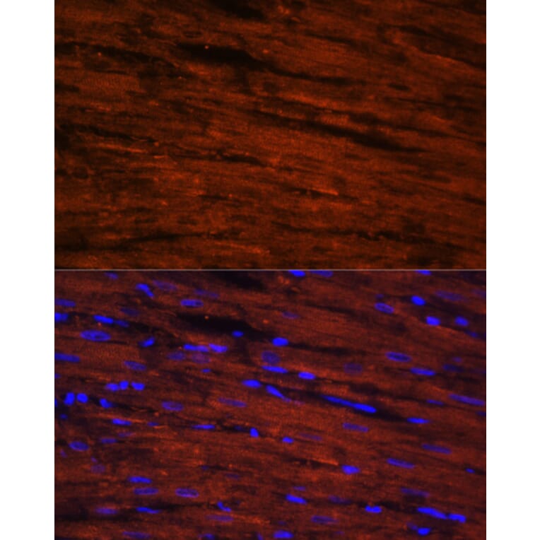 Immunofluorescence - Anti-LDB3 Antibody (A15716) - Antibodies.com