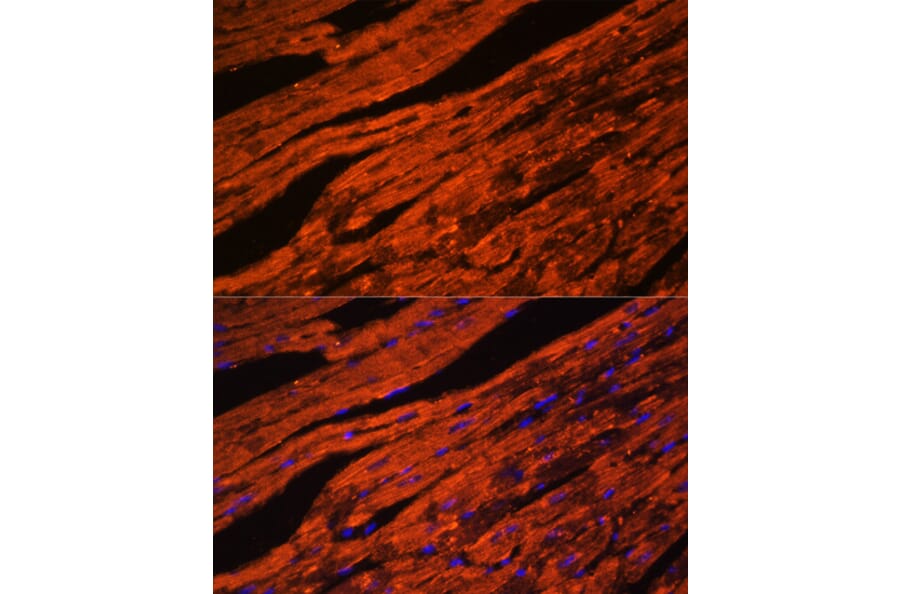 Immunofluorescence - Anti-LDB3 Antibody (A15716) - Antibodies.com