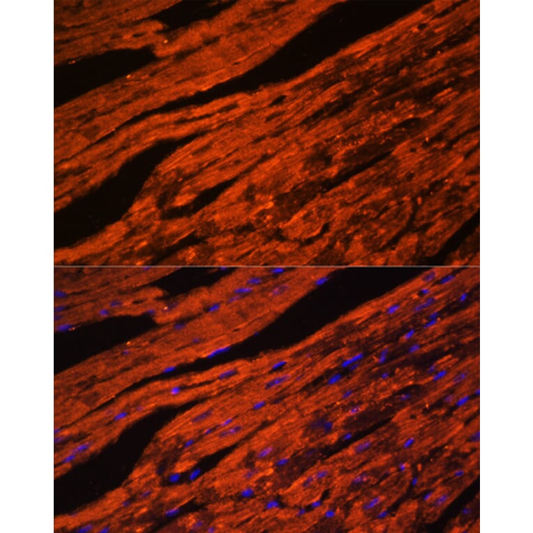 Immunofluorescence - Anti-LDB3 Antibody (A15716) - Antibodies.com