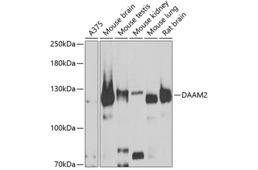 Western Blot - Anti-DAAM2 Antibody (A15717) - Antibodies.com