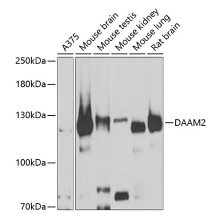 Western Blot - Anti-DAAM2 Antibody (A15717) - Antibodies.com