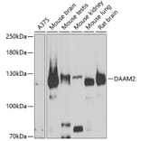 Western Blot - Anti-DAAM2 Antibody (A15717) - Antibodies.com