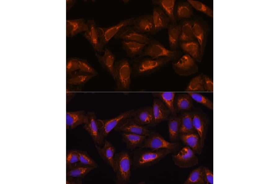Immunofluorescence - Anti-DAAM2 Antibody (A15717) - Antibodies.com