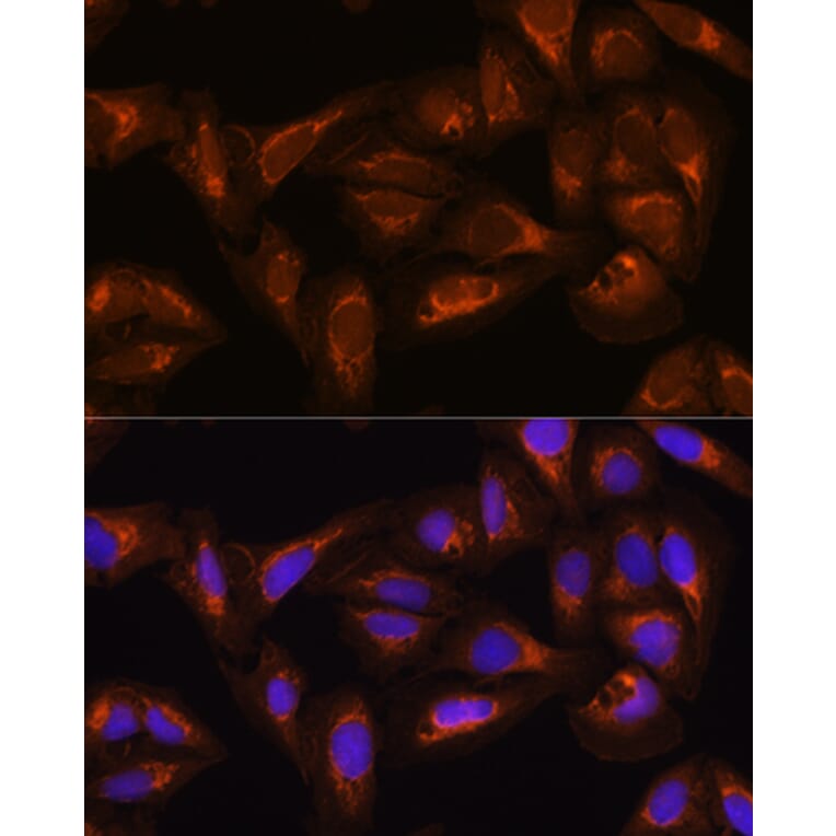 Immunofluorescence - Anti-DAAM2 Antibody (A15717) - Antibodies.com
