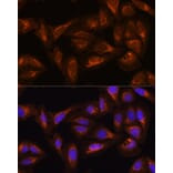 Immunofluorescence - Anti-DAAM2 Antibody (A15717) - Antibodies.com
