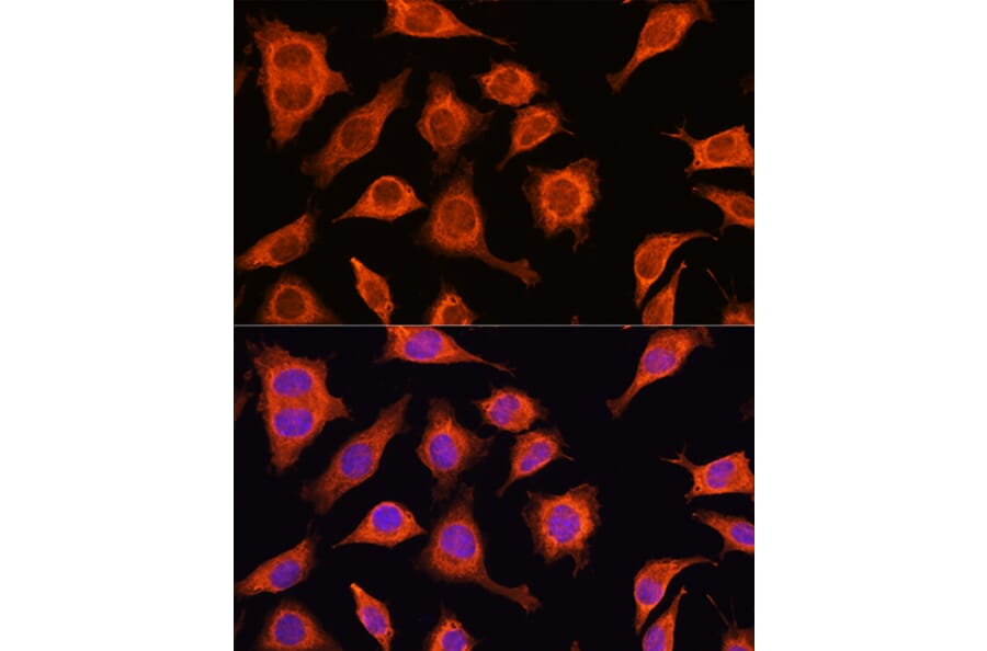 Immunofluorescence - Anti-DAAM2 Antibody (A15717) - Antibodies.com
