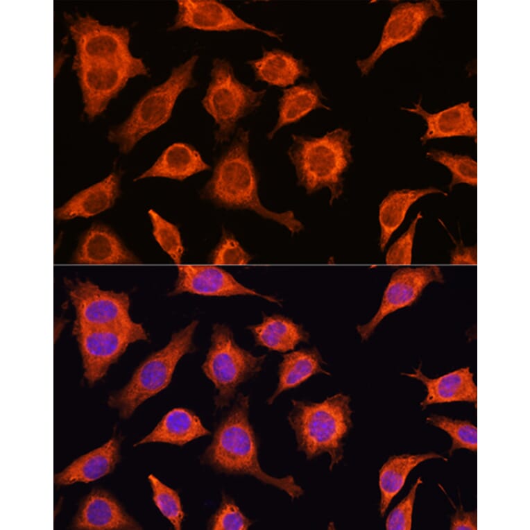 Immunofluorescence - Anti-DAAM2 Antibody (A15717) - Antibodies.com