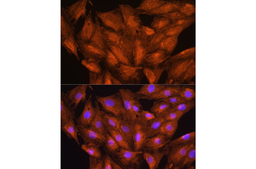 Immunofluorescence - Anti-DAAM2 Antibody (A15717) - Antibodies.com