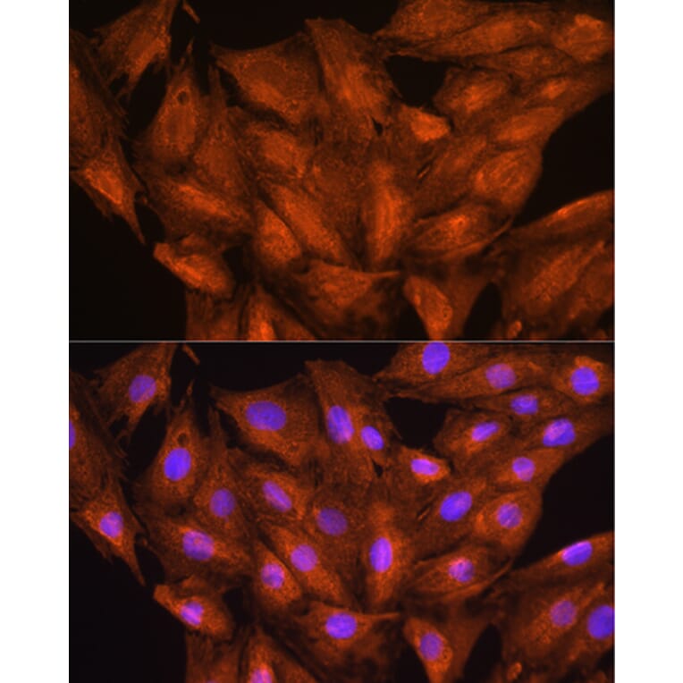 Immunofluorescence - Anti-DAAM2 Antibody (A15717) - Antibodies.com