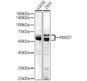 Western Blot - Anti-FBXO7 Antibody (A15718) - Antibodies.com