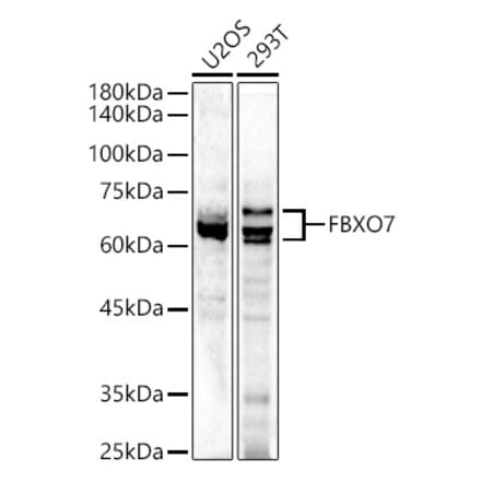 Western Blot - Anti-FBXO7 Antibody (A15718) - Antibodies.com