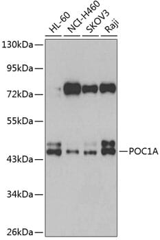 Western blot analysis of extracts of various cell lines, using Anti-POC1A Antibody (A7465) at 1:1,000 dilution.
Secondary antibody: Goat Anti-Rabbit IgG (H+L) (HRP) (AS014) at 1:10,000 dilution.
Lysates / proteins: 25µg per lane.
Blocking buffer: 3% non-fat dry milk in TBST.
Detection: ECL Basic Kit (RM00020).
Exposure time: 90s.