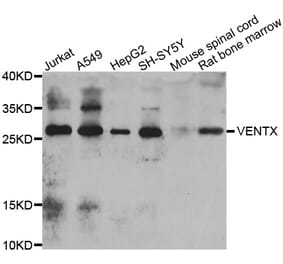 Western Blot - Anti-VENTX Antibody (A7467) - Antibodies.com