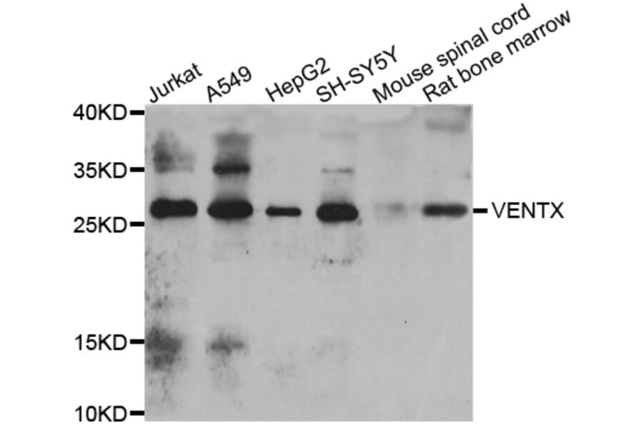 Western Blot - Anti-VENTX Antibody (A7467) - Antibodies.com