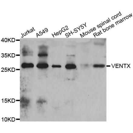 Western Blot - Anti-VENTX Antibody (A15720) - Antibodies.com