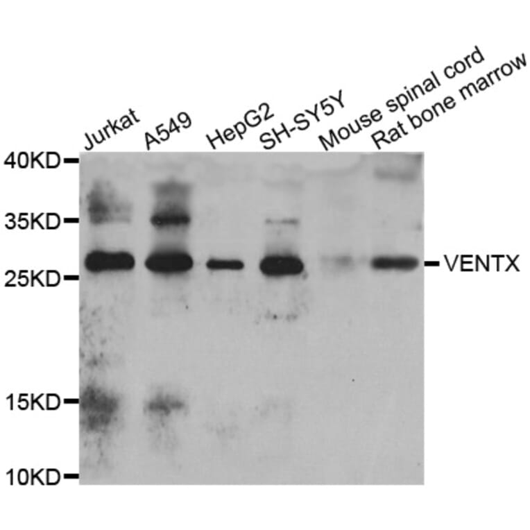 Western Blot - Anti-VENTX Antibody (A7467) - Antibodies.com