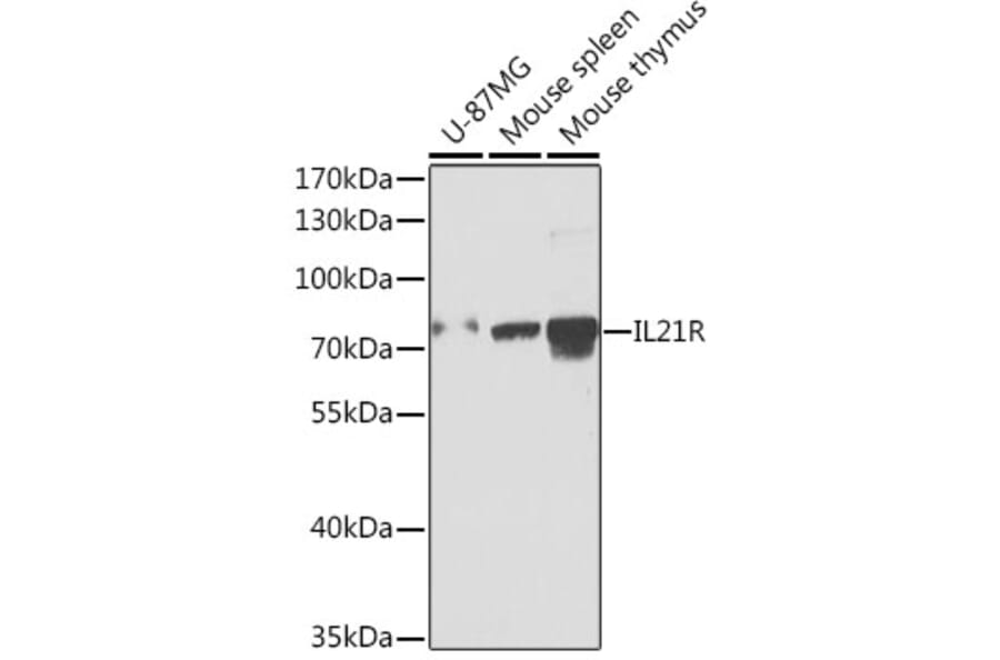 Western Blot - Anti-IL-21R Antibody (A15721) - Antibodies.com