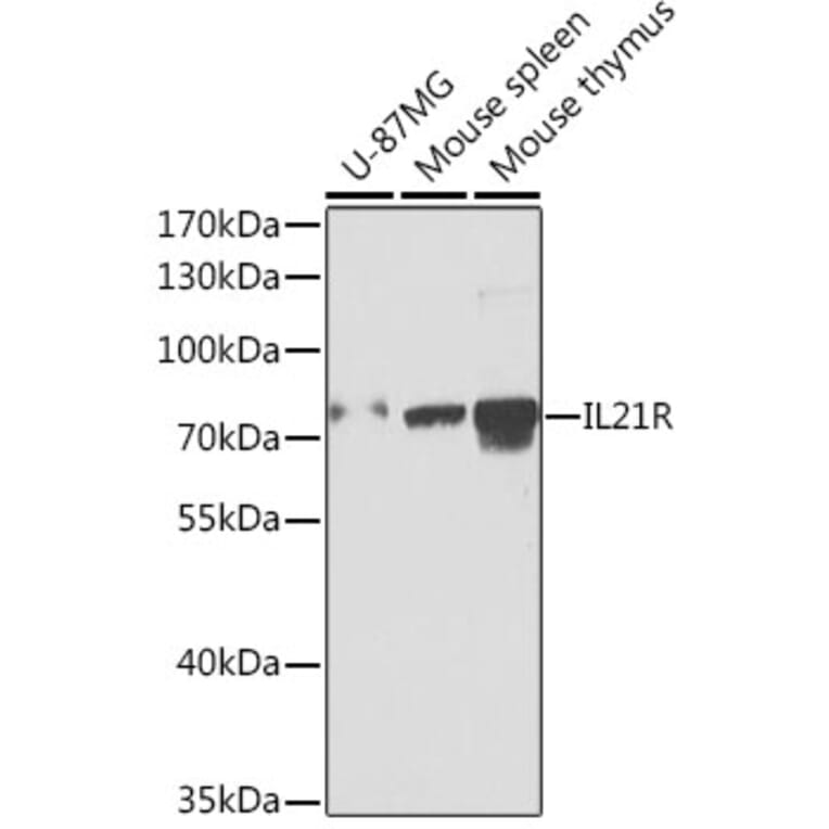Western Blot - Anti-IL-21R Antibody (A15721) - Antibodies.com
