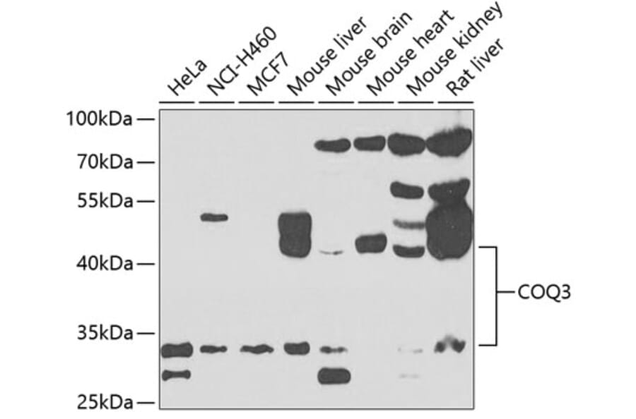 Western Blot - Anti-COQ3 Antibody (A15722) - Antibodies.com