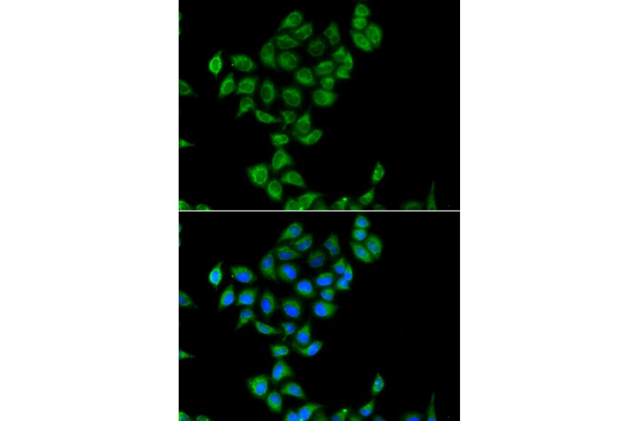 Immunofluorescence - Anti-COQ3 Antibody (A15722) - Antibodies.com