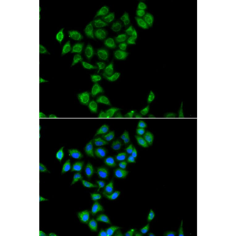 Immunofluorescence - Anti-COQ3 Antibody (A15722) - Antibodies.com