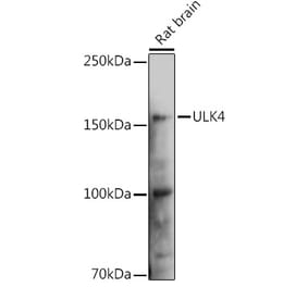 Western Blot - Anti-ULK4 Antibody (A15723) - Antibodies.com