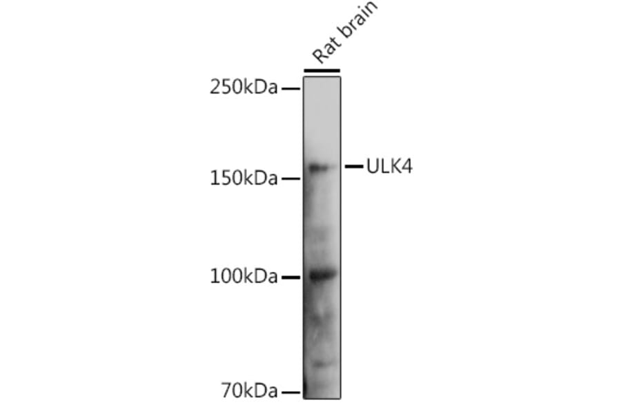Western Blot - Anti-ULK4 Antibody (A15723) - Antibodies.com