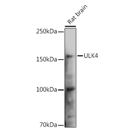 Western Blot - Anti-ULK4 Antibody (A15723) - Antibodies.com