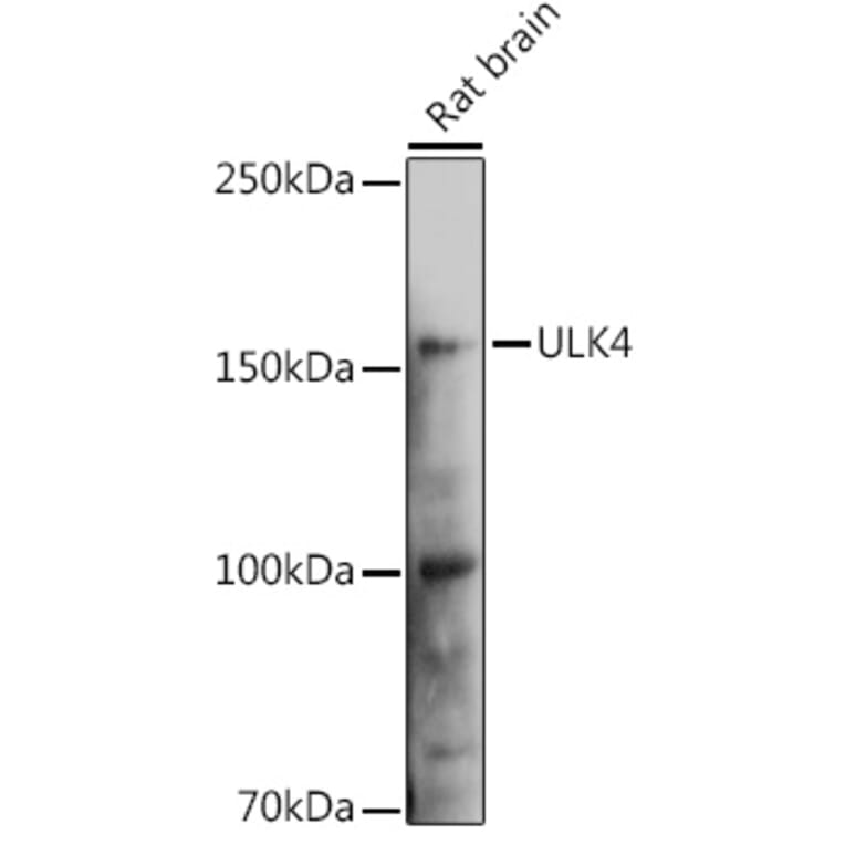 Western Blot - Anti-ULK4 Antibody (A15723) - Antibodies.com