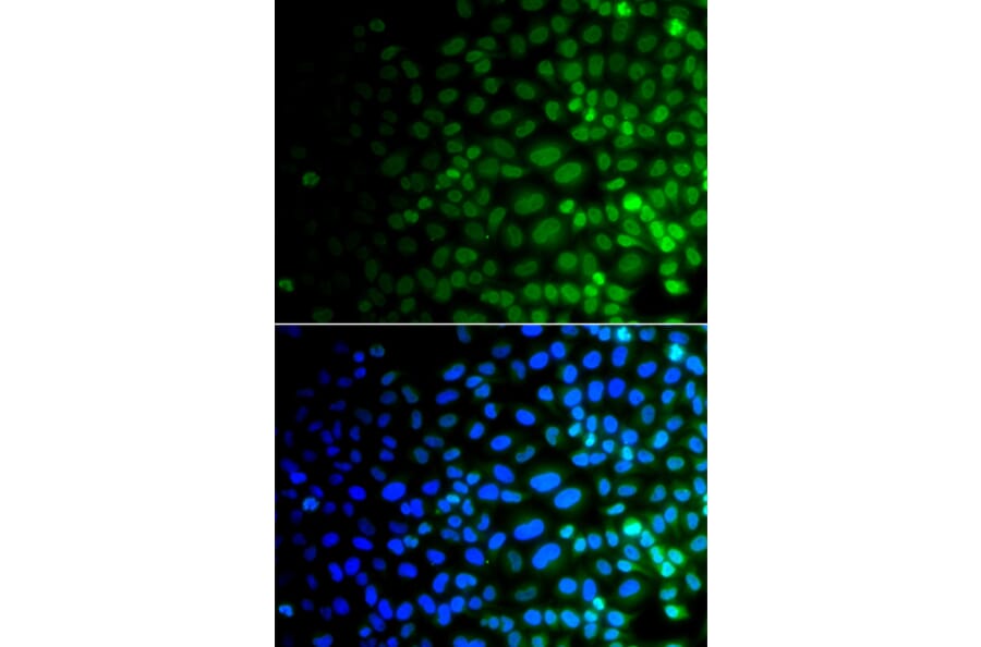Immunofluorescence - Anti-ULK4 Antibody (A15723) - Antibodies.com