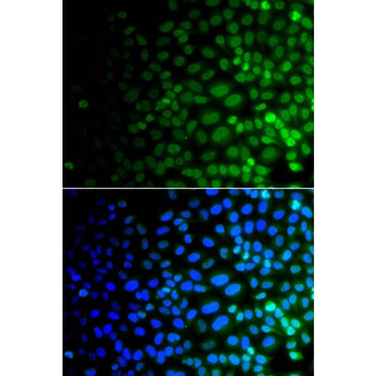 Immunofluorescence - Anti-ULK4 Antibody (A15723) - Antibodies.com