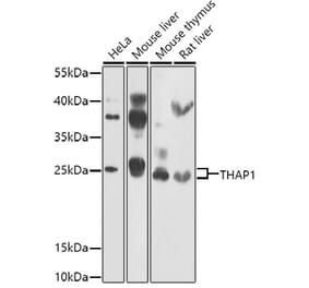 Western Blot - Anti-THAP1 Antibody (A15724) - Antibodies.com