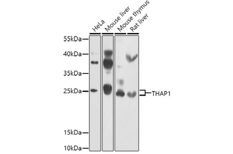 Western Blot - Anti-THAP1 Antibody (A15724) - Antibodies.com