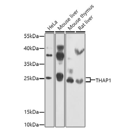 Western Blot - Anti-THAP1 Antibody (A15724) - Antibodies.com