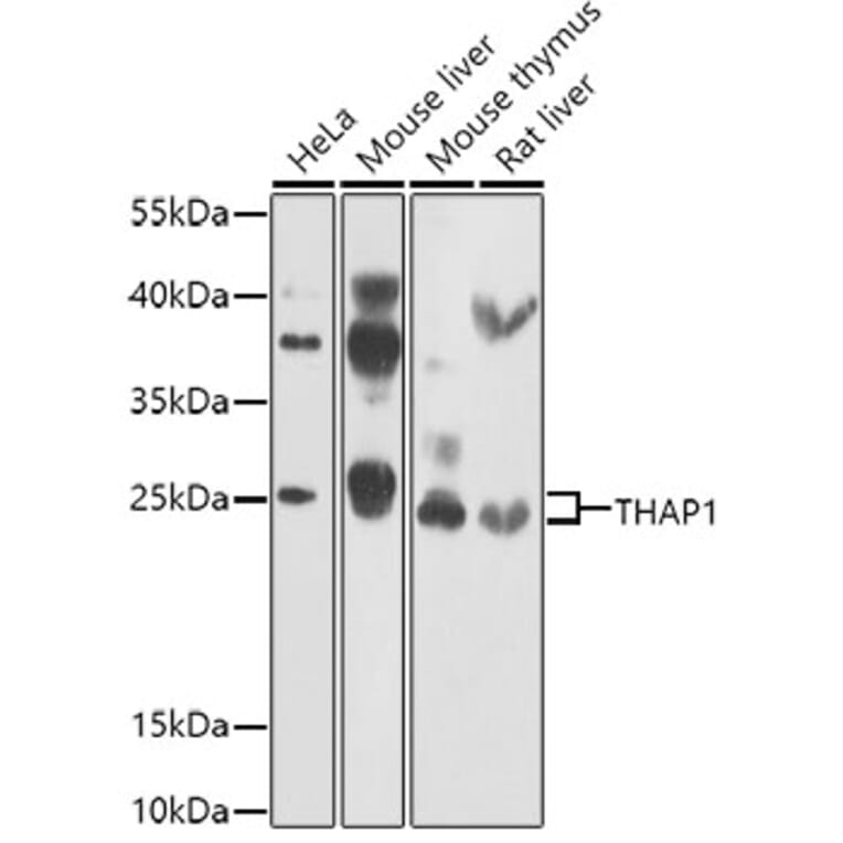 Western Blot - Anti-THAP1 Antibody (A15724) - Antibodies.com