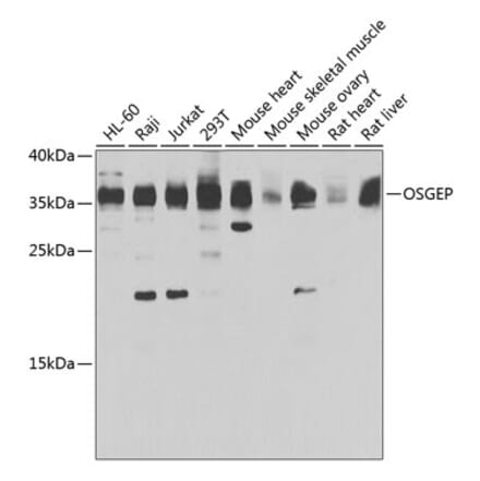 Western Blot - Anti-OSGEP Antibody (A15725) - Antibodies.com