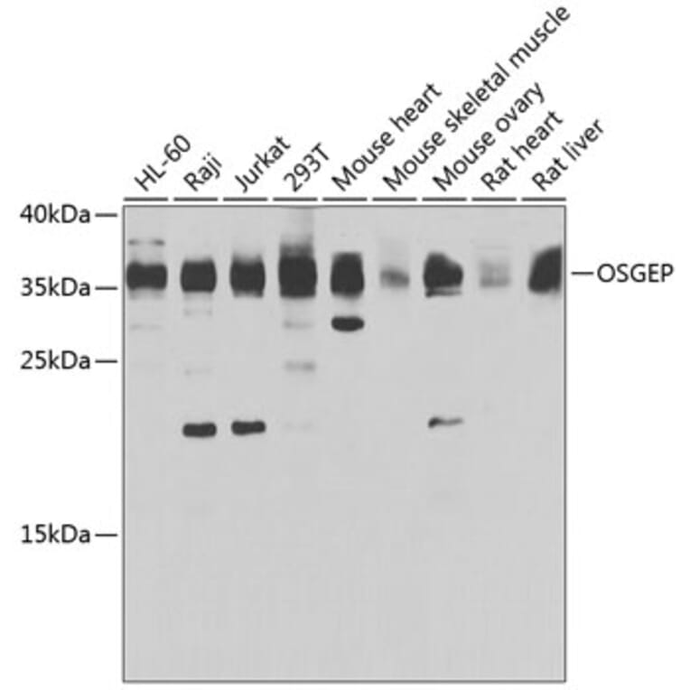 Western Blot - Anti-OSGEP Antibody (A15725) - Antibodies.com